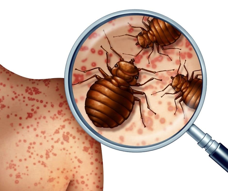 Look at bed bug bites